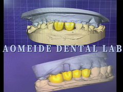 AOMEIDE Dental lab
