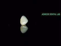 Ceramic Crown Bridge