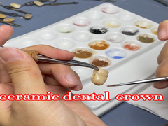 Translucent Natural Looking Zirconia dental Crown with Excellent Durability and Precise Fit