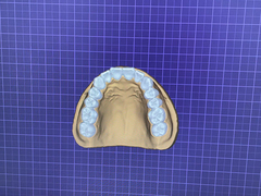 CAD/CAM digital precise cutting, creating the beautiful and natural high-quality oral restorations.