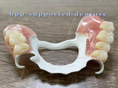 Secure Fit HPP-supported Denture Fair To Good Aesthetics Regular Cleaning And Check Ups Needed