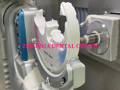 Zirconia Dental Crown for Single/Multi-Unit Fixed Restorations with Enhanced Translucency