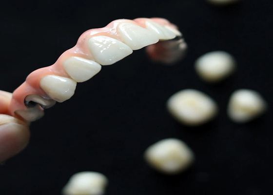 Buy Aesthetic Solution Dental Implant Crown Bridge For Adults Replacing Missing Teeth online manufacture