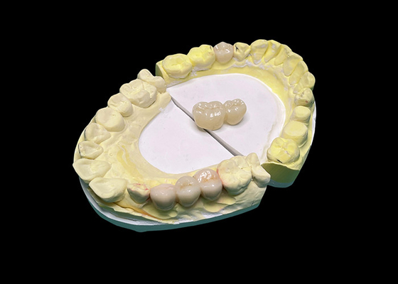 Buy Advanced Translucency Ceramic Crowns and Bridges Enhance Your Smile with Precision and Natural Aesthetics for Long-lasting Durability online manufacture