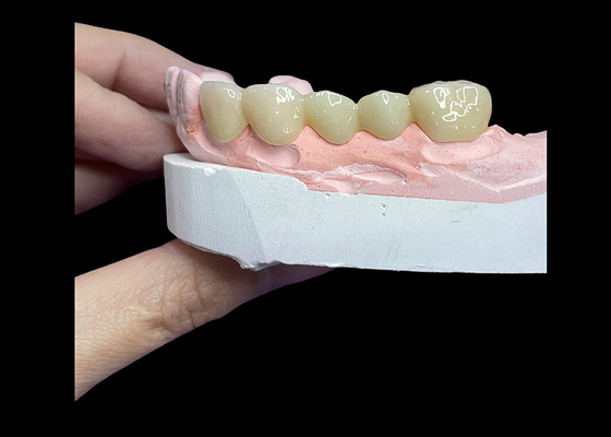 Buy All Ceramic Crowns and Bridges Designed for Superior Aesthetics Durability and Natural Fit for Long-Lasting Confidence online manufacture