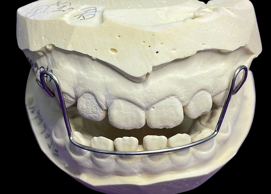 Buy Guide Arch Appliance Orthodontic Retainers Aligners With Good Retention Proven Convenience online manufacture