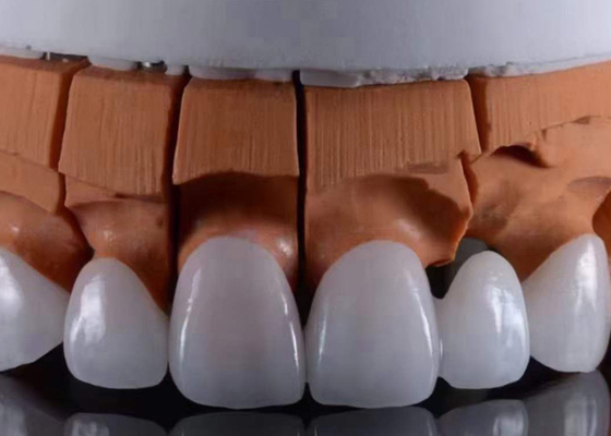 Buy FDA Approved Translucent Zirconia dental Crowns Precise Fit with Natural Aesthetic Appearance online manufacture