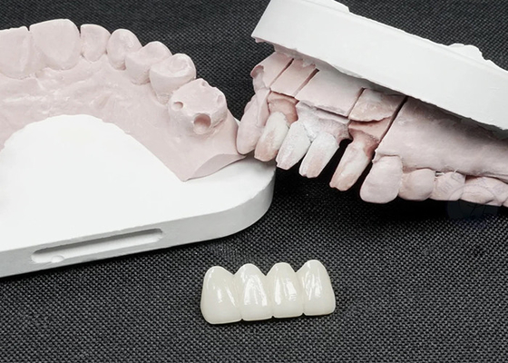 Buy Premium Zirconia Dental Crowns for Superior Strength and Natural Aesthetics online manufacture