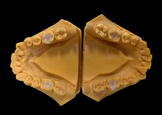 Buy Biocompatible Ceramic Inlays Onlays Seamless Dental Restoration with Stain Resistant Strength online manufacture