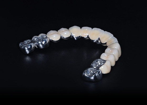 Buy High Durability Biocompatible Porcelain Fused To Metal Crown Precise Fit Custom online manufacture