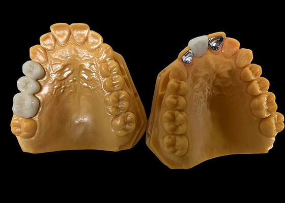 Buy Moderate Translucency Porcelain Fused To Metal PFM Crown , PFM Ceramic Crown online manufacture