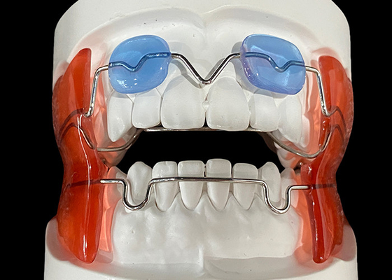 Buy Frankel 2/3 Orthodontic Appliance, enhancing Jaw Alignment in Growing Children online manufacture