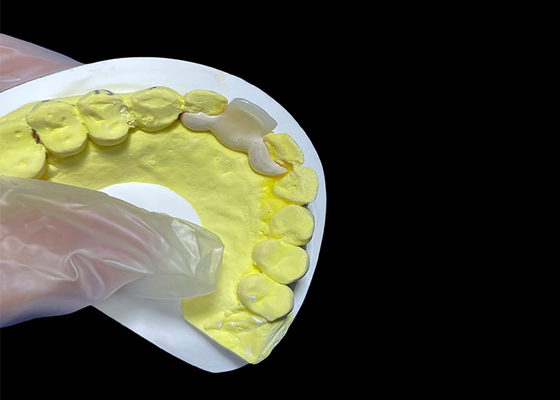 Buy Natural Looking Dental Ceramic Crown HPP Bonded Ceramic Bridge Easy Cleaning online manufacture