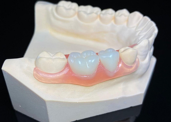 Buy OEM Invisible Removable Dentures Custom Acrylic Resin Partial Dental Prosthesis online manufacture