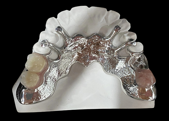 Buy Customizable Cast Partial Removable Denture With Acrylic Resin / Metal Base Design online manufacture
