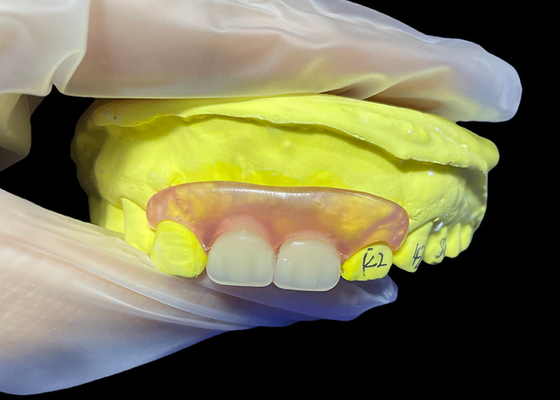 Buy Tailored Secure Fit invisible Flexible Parital Denture Replacement For Comfortable Chewing And Speaking online manufacture