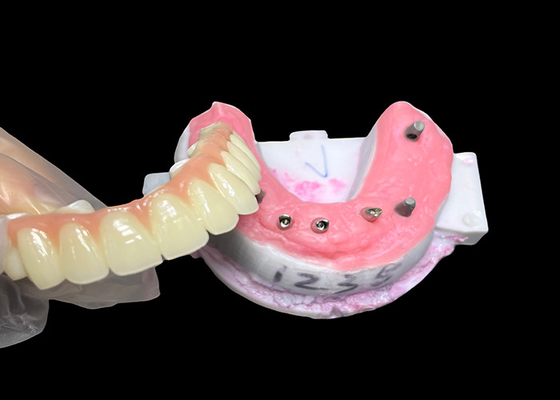 Buy Implant supported Full Arch Denture Fixed Dental implant Ceramic Crown Bridge online manufacture