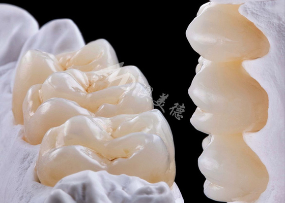 Buy High Strength Zirconia Dental Crown For Single Or Multiple Teeth Replacement online manufacture