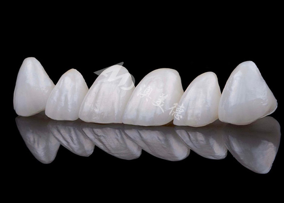 Buy Natural Looking Zirconia Tooth Crown Stain Resistance All Zirconia Crown online manufacture