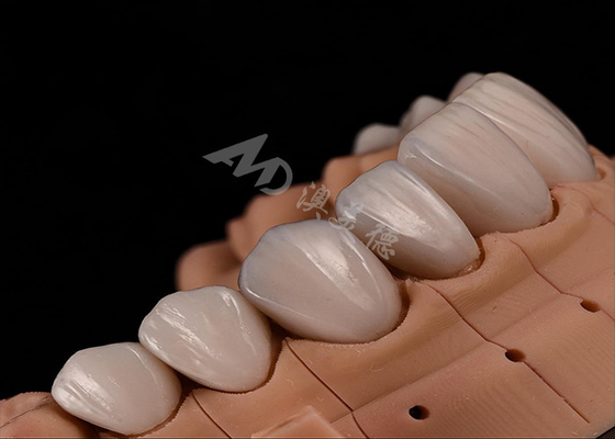 Buy Strength Natural Esthetics Teeth Zirconia Crowns For Precise Fit Chip Resistance online manufacture