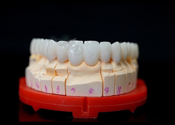 Buy Precise Fit Full Zirconia Crowns , Highly Biocompatible Zirconia Crowns For Teeth online manufacture