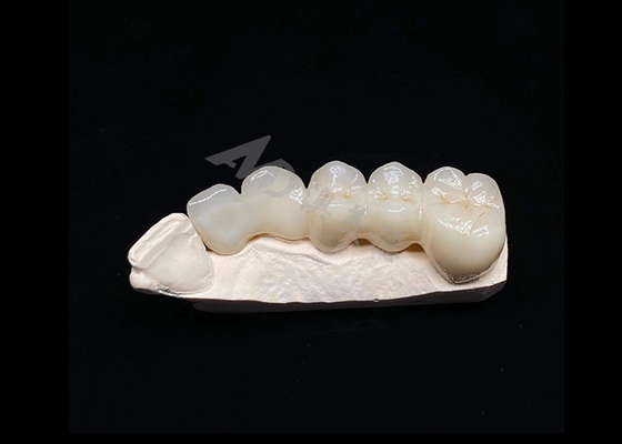 Buy Translucency Natural Esthetics Solid Zirconia Crown For Teeth Chipping Resistant online manufacture