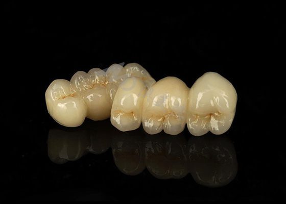 Buy Stain Resistant Solid Zirconia Crown Combining Excellent Bio Compatibility online manufacture