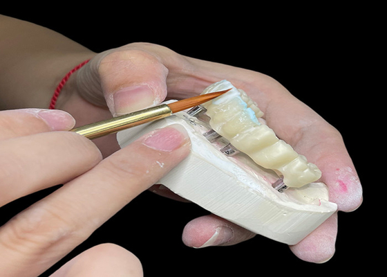 Buy Customizable Polished Dental Implant Crown Bridge Long Lasting for Easy Hygiene online manufacture