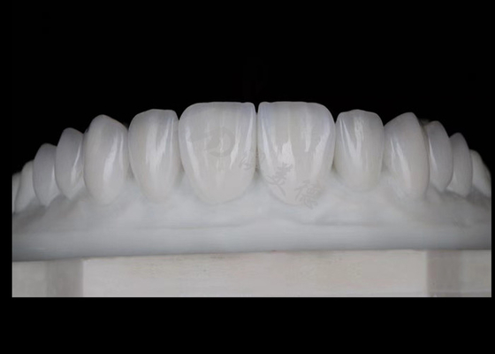 Buy Translucency Natural Esthetic Zirconia Crowns Excellent Biocompatibility And Strength online manufacture