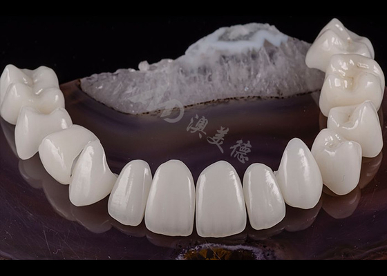 Buy Translucent Dental Tooth Solid Zirconia Crown Natural Aesthetics Chipping Resistance online manufacture