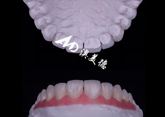 Buy Translucency EMAX Porcelain Veneer Resistant to Stains / Strength online manufacture