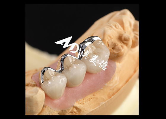 Buy Strong PFM Porcelain Fused To Metal Crown Excellent Biocompatibility Wear Resistance online manufacture