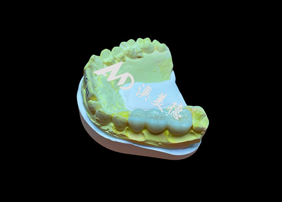 Buy Customized Smooth Surface Zirconia Dental Crown High Biocompatibility Stain Resistance online manufacture