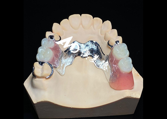 Buy Removable Denture with Cast Metal Framework for Superior Strength and Stability with Long Lasting Comfort online manufacture