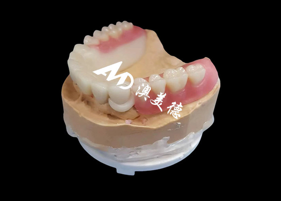 Buy Customized Hpp Frame Acrylic Removable Partial Denture For Missing Teeth online manufacture