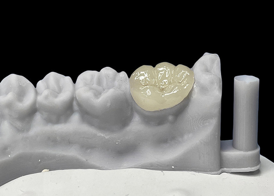 Buy Accurate Fit Dental Ceramic Inlays Onlays , Porcelain Inlays And Onlays FDA Approved online manufacture