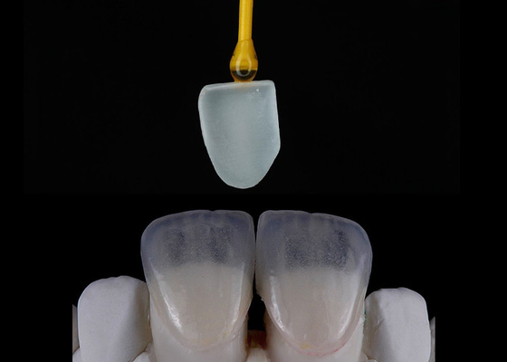Buy Custom Made Dental Restoration EMAX Veneers Beautifully Aligned Digital Impression online manufacture