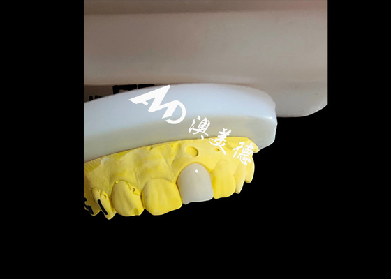 Buy Natural Looking Aesthetic Zirconia Dental Crown Flawless Fit Teeth Restoration online manufacture