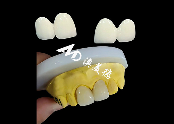 Buy Custom Zirconia Dental Crown Precise Fit Tooth Cap from China dental lab online manufacture