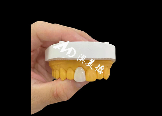 Buy Anterior incisor Zirconia Dental Crown Natural Looking High Strength Wear Resistance online manufacture
