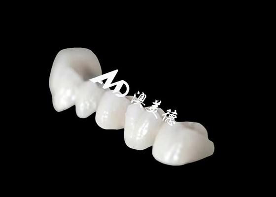 Buy Full Arch Zriconia Dental Crown With Astonishing Natural Appearance online manufacture