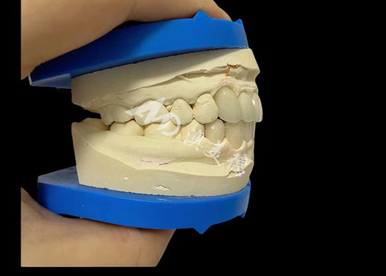 Buy Unbeatable Strength Dental Zirconia Dentla Crown For Natural Looking Smiles online manufacture