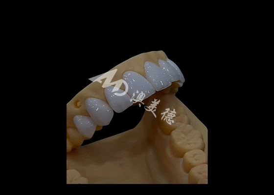 Buy Prosthetic Dentistry Zirconia Dental Crown Precise Fit Aesthetics For full arch teeth online manufacture