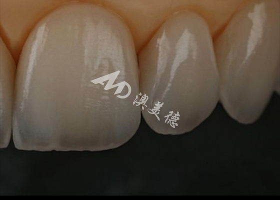 Buy Chipping Resistance  Zirconia Dental Crown For Anterior Teeth / Posterior Teeth online manufacture