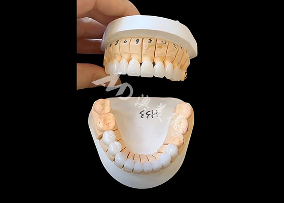 Buy Enhanced Translucency Zirconia Dental Crown For Single / Multi Unit Fixed Restorations online manufacture