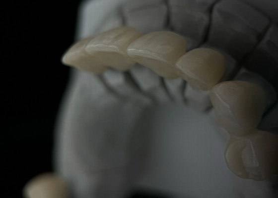 Buy Fit Monolithic Zirconia Tooth Crown With Translucency And Resistance online manufacture