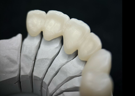 Buy Dental Solid Zirconia Crown Ombining Outstanding Strength And Natural Aesthetics online manufacture