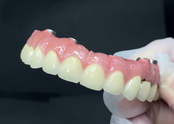 Buy Durable Dental Implants with Easy-to-Clean Titanium Abutment and Zirconia Crown online manufacture