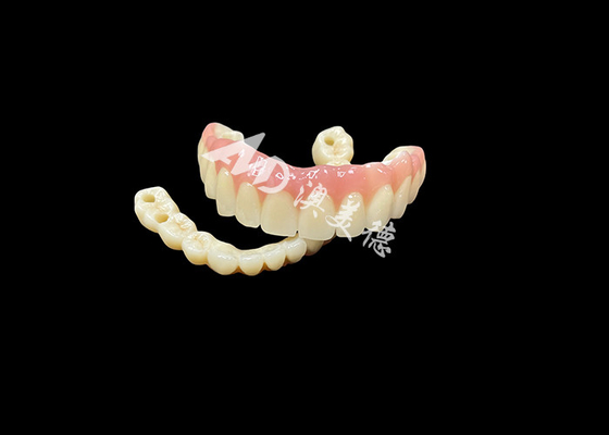 Buy Implant supported dentures  Bridge The Ultimate Dental Solution For Missing Teeth online manufacture