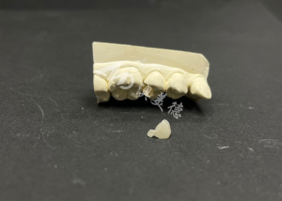 Buy Hypoallergenic Stain-Resistant Emax Ceramic Inlay for Accurate Repair of Damaged Teeth online manufacture